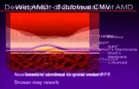 Macular Degeneration (2/6) A Scientific Explanation